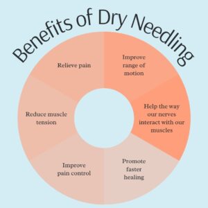 benefits of functional dry needling